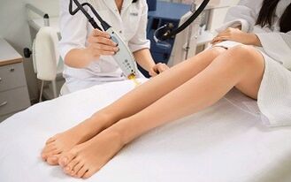 que está permitido e prohibido para varices