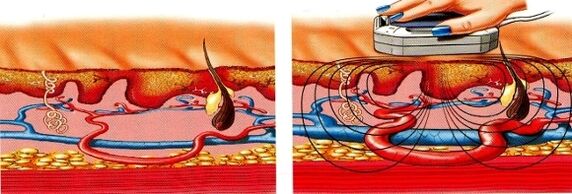 se as pernas quedan adormecidas